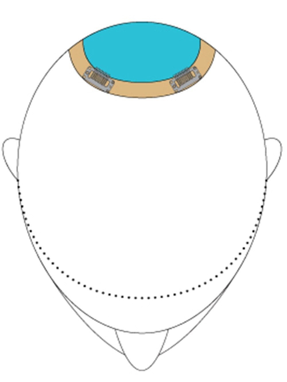 Top This 16 | Remy Human Hair Topper - Image 7